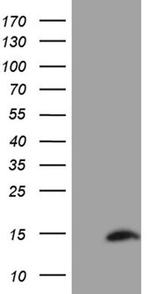 SH3BGRL Antibody in Western Blot (WB)