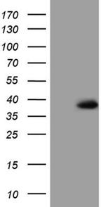 TRIP13 Antibody in Western Blot (WB)