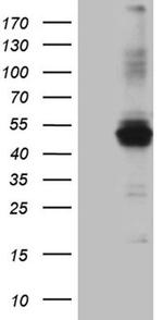 AGPAT9 Antibody in Western Blot (WB)