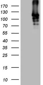 SIRT1 Antibody in Western Blot (WB)