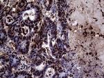 TALDO1 Antibody in Immunohistochemistry (Paraffin) (IHC (P))