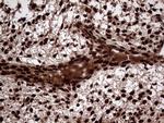 TALDO1 Antibody in Immunohistochemistry (Paraffin) (IHC (P))