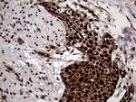 TALDO1 Antibody in Immunohistochemistry (Paraffin) (IHC (P))