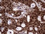 TALDO1 Antibody in Immunohistochemistry (Paraffin) (IHC (P))