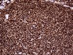 TALDO1 Antibody in Immunohistochemistry (Paraffin) (IHC (P))