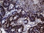 TALDO1 Antibody in Immunohistochemistry (Paraffin) (IHC (P))