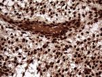 TALDO1 Antibody in Immunohistochemistry (Paraffin) (IHC (P))