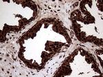 TALDO1 Antibody in Immunohistochemistry (Paraffin) (IHC (P))