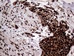 TALDO1 Antibody in Immunohistochemistry (Paraffin) (IHC (P))