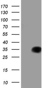 TALDO1 Antibody in Western Blot (WB)