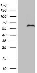 PRRT2 Antibody in Western Blot (WB)