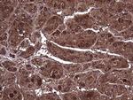 AMDHD1 Antibody in Immunohistochemistry (Paraffin) (IHC (P))