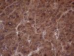 AMDHD1 Antibody in Immunohistochemistry (Paraffin) (IHC (P))