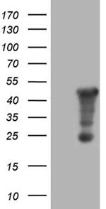 AMDHD1 Antibody in Western Blot (WB)