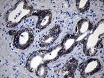 ROR2 Antibody in Immunohistochemistry (Paraffin) (IHC (P))