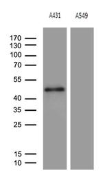 ELF3 Antibody in Western Blot (WB)