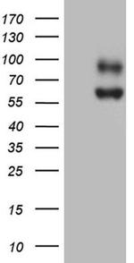 SLC39A5 Antibody in Western Blot (WB)