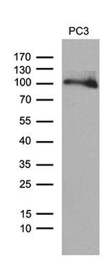 UHRF2 Antibody in Western Blot (WB)