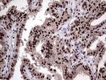 PPP4C Antibody in Immunohistochemistry (Paraffin) (IHC (P))