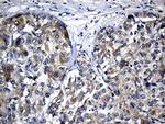 CHP1 Antibody in Immunohistochemistry (Paraffin) (IHC (P))