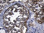 CHP1 Antibody in Immunohistochemistry (Paraffin) (IHC (P))