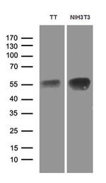 LHX2 Antibody in Western Blot (WB)