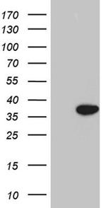 FBXO6 Antibody in Western Blot (WB)