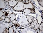 PSMA7 Antibody in Immunohistochemistry (Paraffin) (IHC (P))