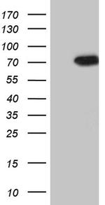 PIKFYVE Antibody in Western Blot (WB)