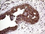 ARHGEF18 Antibody in Immunohistochemistry (Paraffin) (IHC (P))