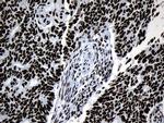 MED19 Antibody in Immunohistochemistry (Paraffin) (IHC (P))