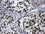 MED19 Antibody in Immunohistochemistry (Paraffin) (IHC (P))