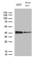 RCAN1 Antibody in Western Blot (WB)