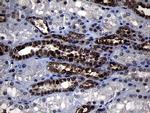 RRM2 Antibody in Immunohistochemistry (Paraffin) (IHC (P))