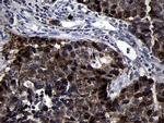 RRM2 Antibody in Immunohistochemistry (Paraffin) (IHC (P))