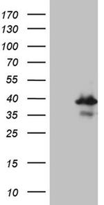 RPAIN Antibody in Western Blot (WB)