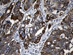 CPT1B Antibody in Immunohistochemistry (Paraffin) (IHC (P))