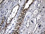 CPT1B Antibody in Immunohistochemistry (Paraffin) (IHC (P))