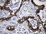 CPT1B Antibody in Immunohistochemistry (Paraffin) (IHC (P))