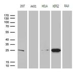 GSTZ1 Antibody in Western Blot (WB)