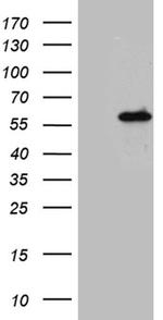 IkB epsilon Antibody in Western Blot (WB)