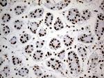 hnRNP H1 Antibody in Immunohistochemistry (Paraffin) (IHC (P))