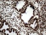 hnRNP H1 Antibody in Immunohistochemistry (Paraffin) (IHC (P))