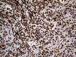 hnRNP H1 Antibody in Immunohistochemistry (Paraffin) (IHC (P))