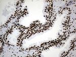 hnRNP H1 Antibody in Immunohistochemistry (Paraffin) (IHC (P))