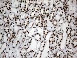 hnRNP H1 Antibody in Immunohistochemistry (Paraffin) (IHC (P))