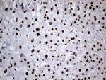 hnRNP H1 Antibody in Immunohistochemistry (Paraffin) (IHC (P))