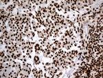 hnRNP H1 Antibody in Immunohistochemistry (Paraffin) (IHC (P))