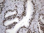 hnRNP H1 Antibody in Immunohistochemistry (Paraffin) (IHC (P))