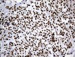 hnRNP H1 Antibody in Immunohistochemistry (Paraffin) (IHC (P))